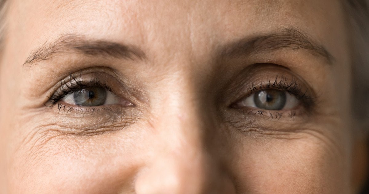 Блефаропластика після 60 років