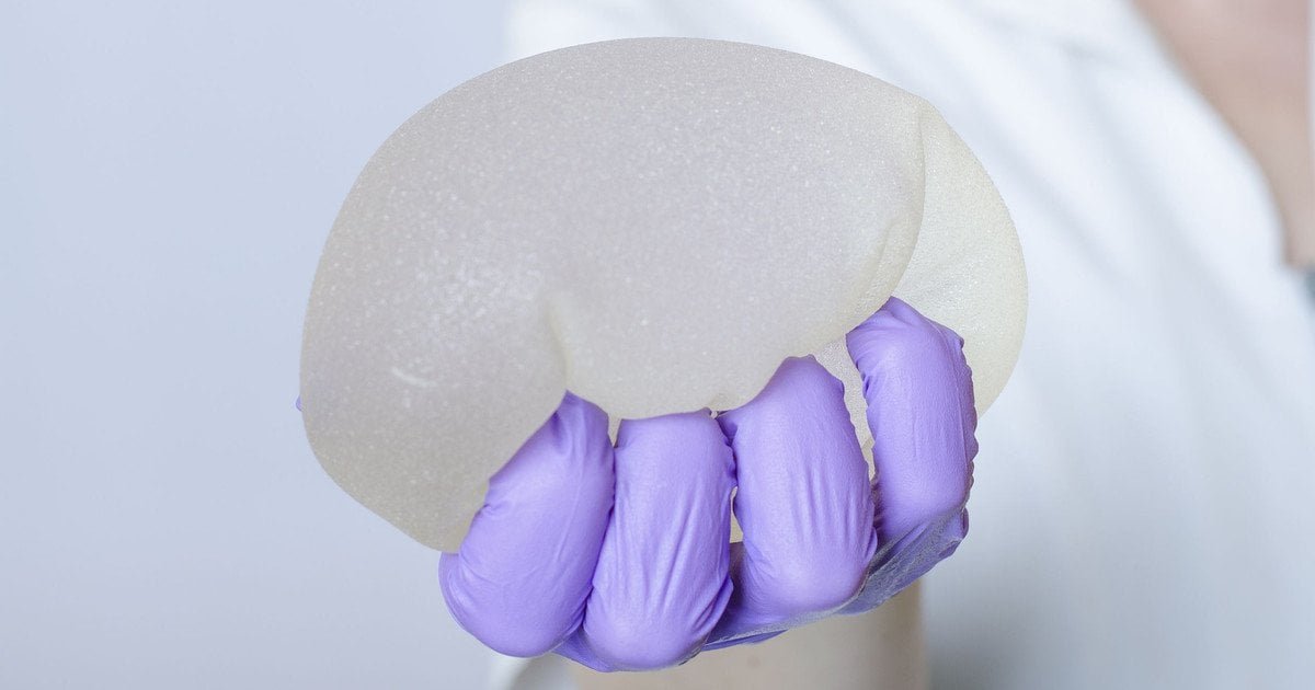 Що важливо знати жінці перед та після встановлення імплантів: поради мамологині